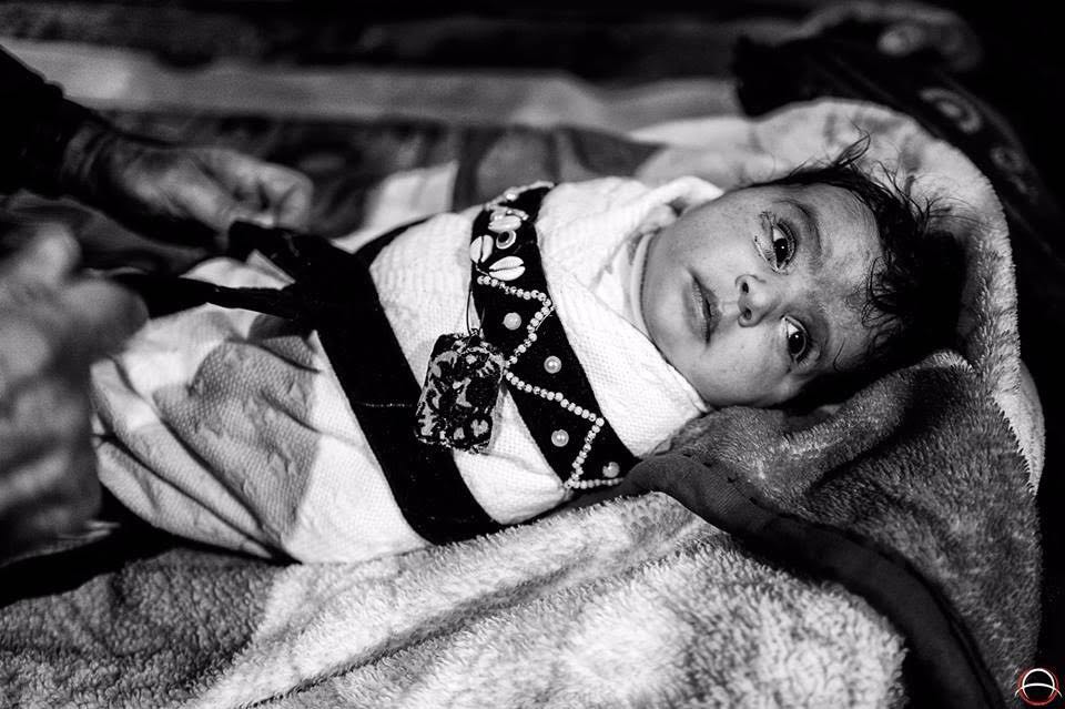 we need your support we need your support